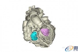 3D打印更精确心脏模型（图文教程）
