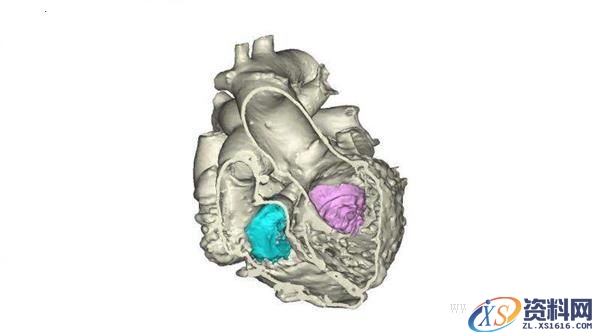 3D打印更精确心脏模型（图文教程）,3D打印更精确心脏模型,模型,打印,第1张