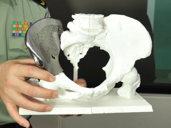 科学家正开发涂层材料以使3D打印骨骼更好地融入人体（图文教程） ...,科学家正开发涂层材料以使3D打印骨骼更好地融入人体,第1张