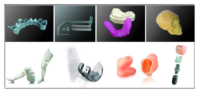 3D打印机的用途（图文教程）,医疗领域,打印机,教程,第2张